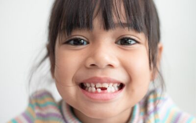 Consejos para Prevenir la Caries Dental en Niños