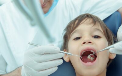 Cómo Motivar a los Niños a Cepillarse los Dientes